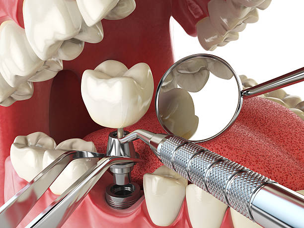 Best Weekend Emergency Dental Services in Olivet, MI